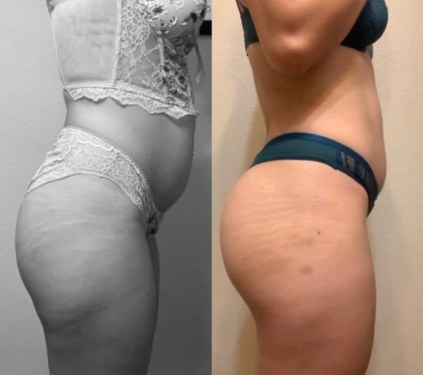 program transformation testimonial image from Client Transformation