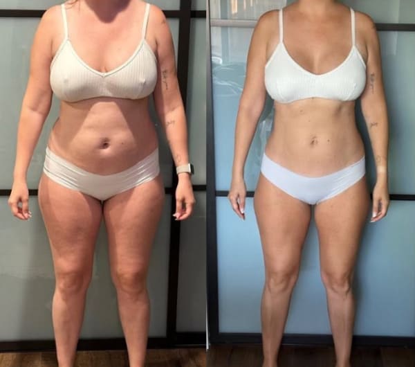 program transformation testimonial image from Nikki