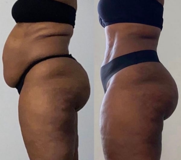 program transformation testimonial image from Client Transformation