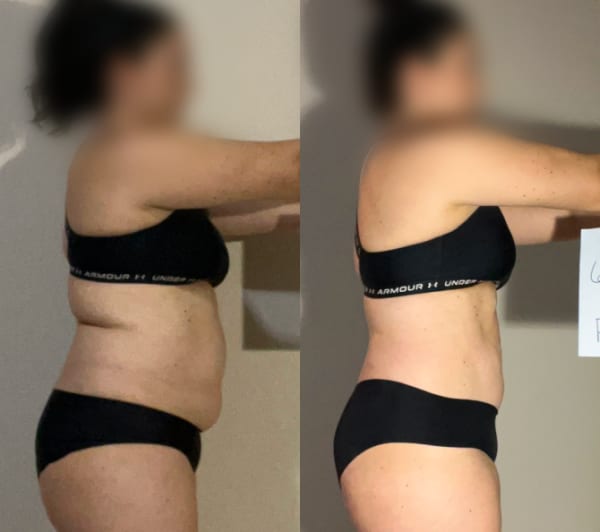 program transformation testimonial image from Melody H.