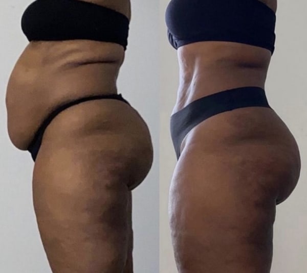 program transformation testimonial image from Client Transformation
