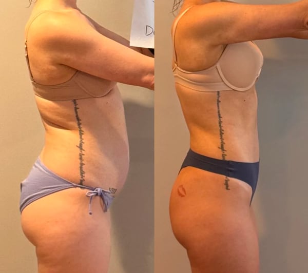 program transformation testimonial image