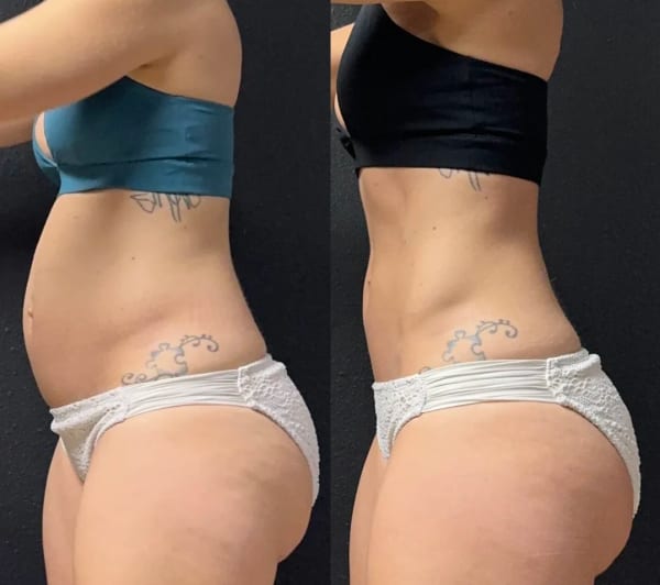 program transformation testimonial image
