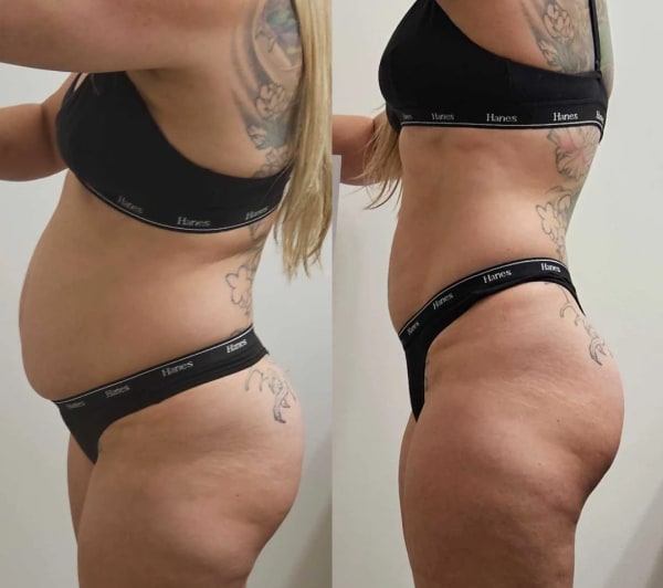 program transformation testimonial image