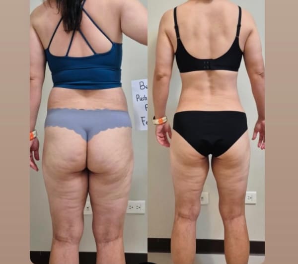 program transformation testimonial image