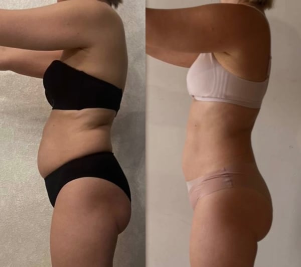 program transformation testimonial image from Client Transformation