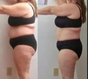 program transformation testimonial image