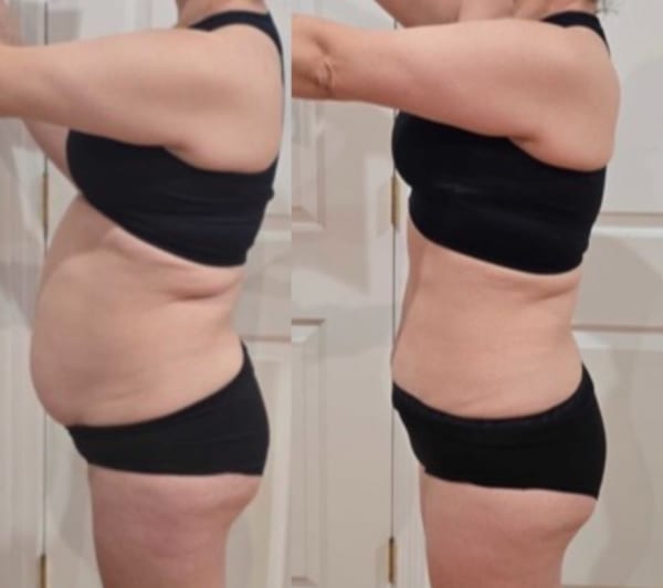 program transformation testimonial image