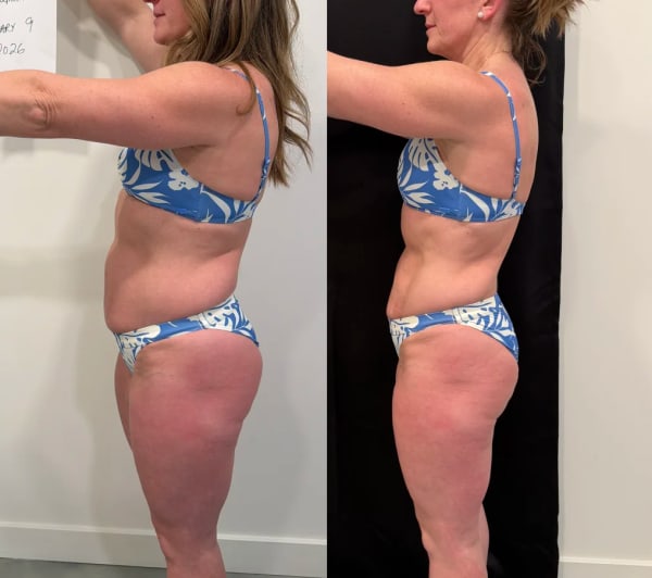 program transformation testimonial image from Angela Z.