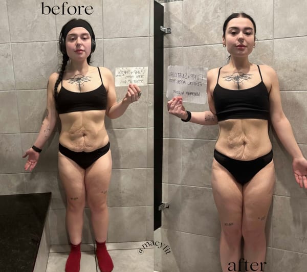 program transformation testimonial image from Abby