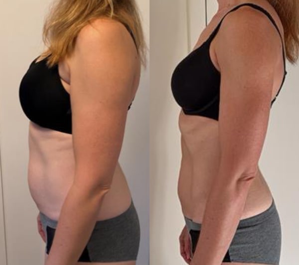 program transformation testimonial image