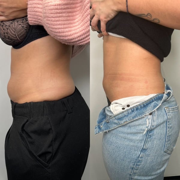 program transformation testimonial image from Destiny 28 years old
