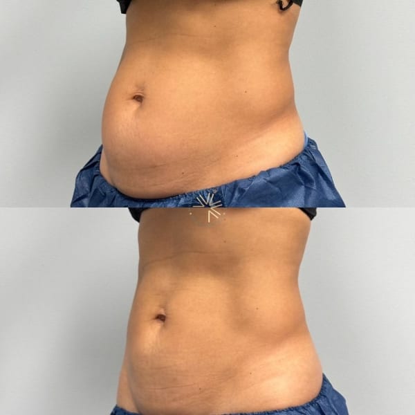 program transformation testimonial image from Michelle, 25 years old mother of 1