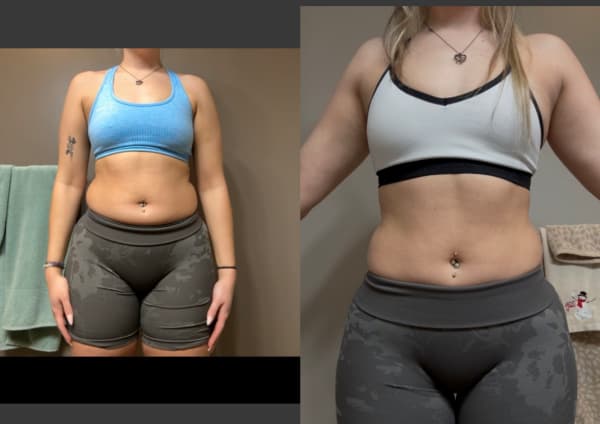 program transformation testimonial image