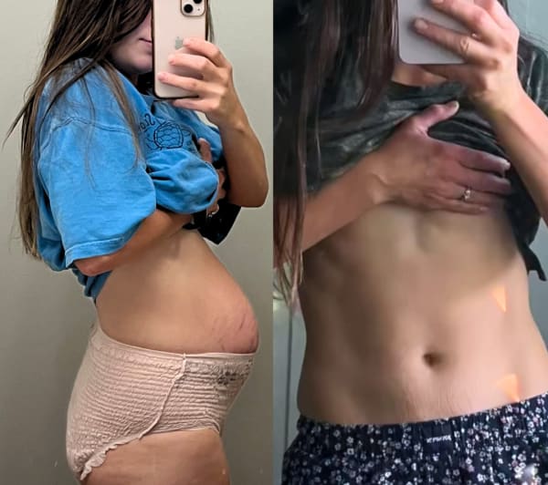 program transformation testimonial image