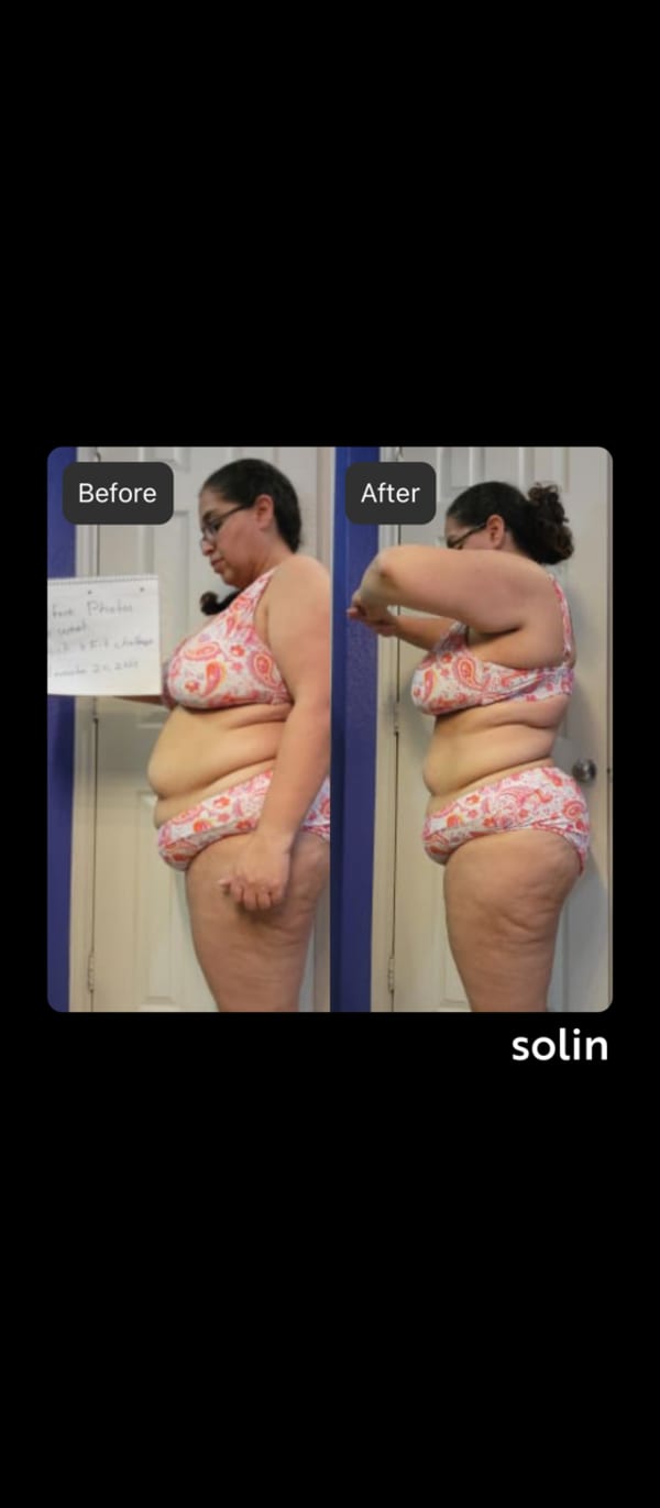 program transformation testimonial image from Elia