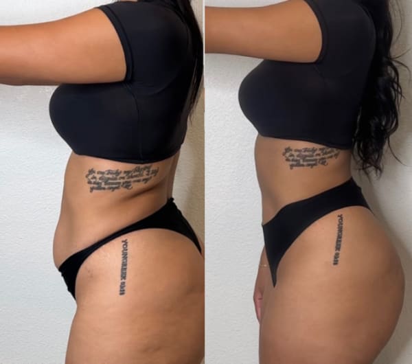 program transformation testimonial image from My Transformation