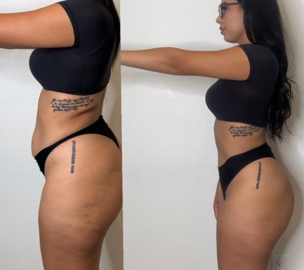 program transformation testimonial image from My Transformation