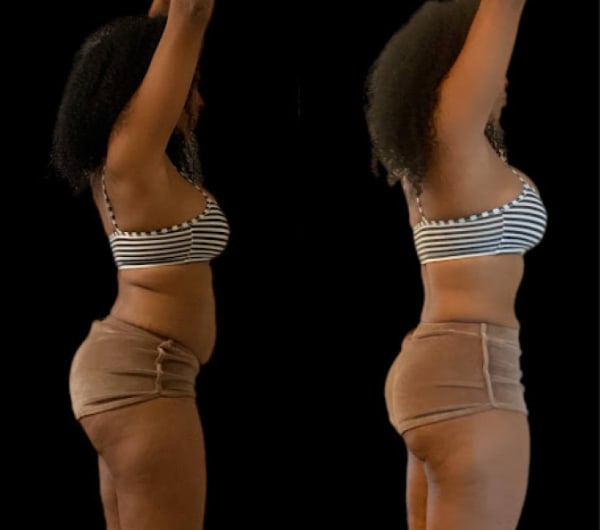 program transformation testimonial image from Client Transformation