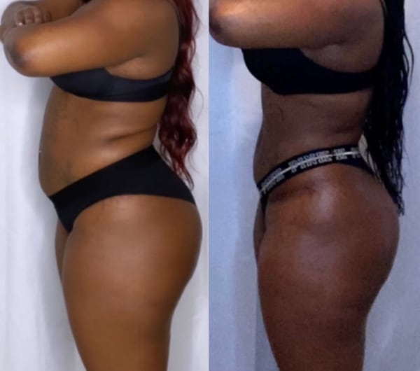 program transformation testimonial image from Client Transformation