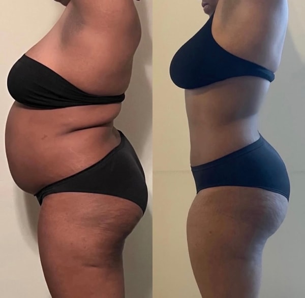 program transformation testimonial image from Client Transformation