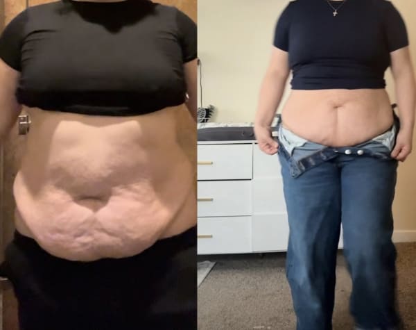 program transformation testimonial image from Apron belly transformation