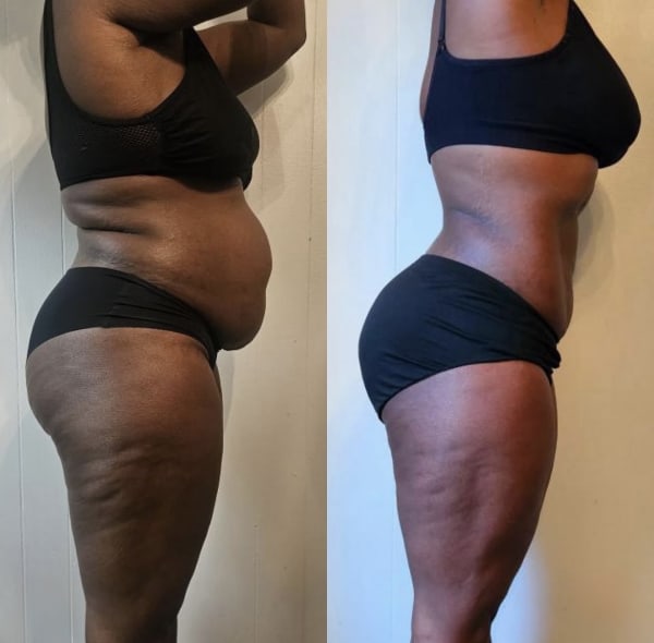 program transformation testimonial image from Client Transformation