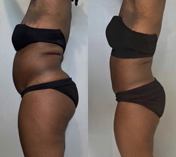 program transformation testimonial image from Client Transformation