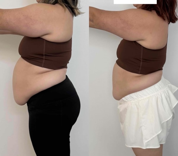 program transformation testimonial image