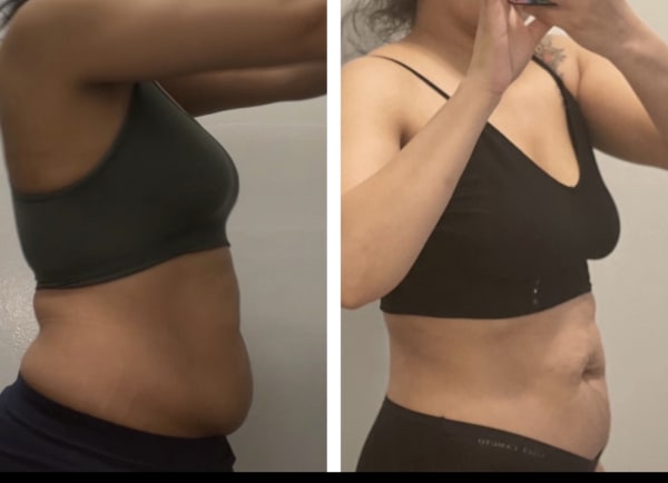 program transformation testimonial image