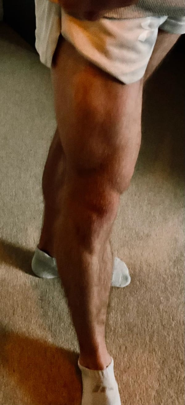 program transformation testimonial image from legs
