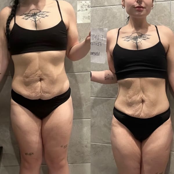 program transformation testimonial image from  