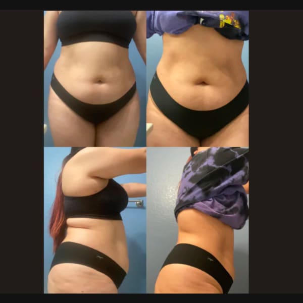 program transformation testimonial image