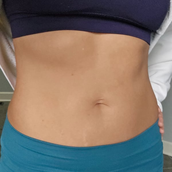 program transformation testimonial image from Corin Harskey, after