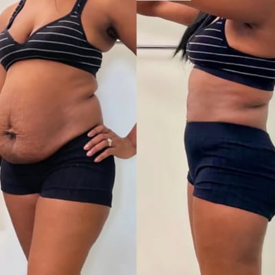 user tranformation testimonial