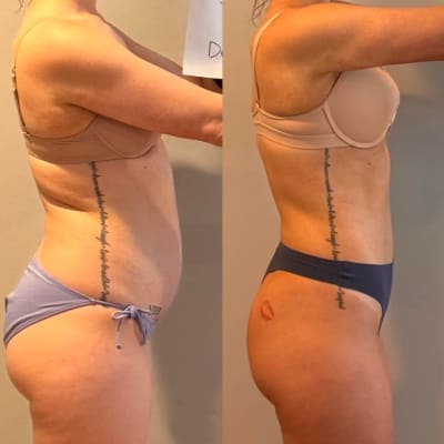 user tranformation testimonial