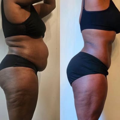 user tranformation testimonial