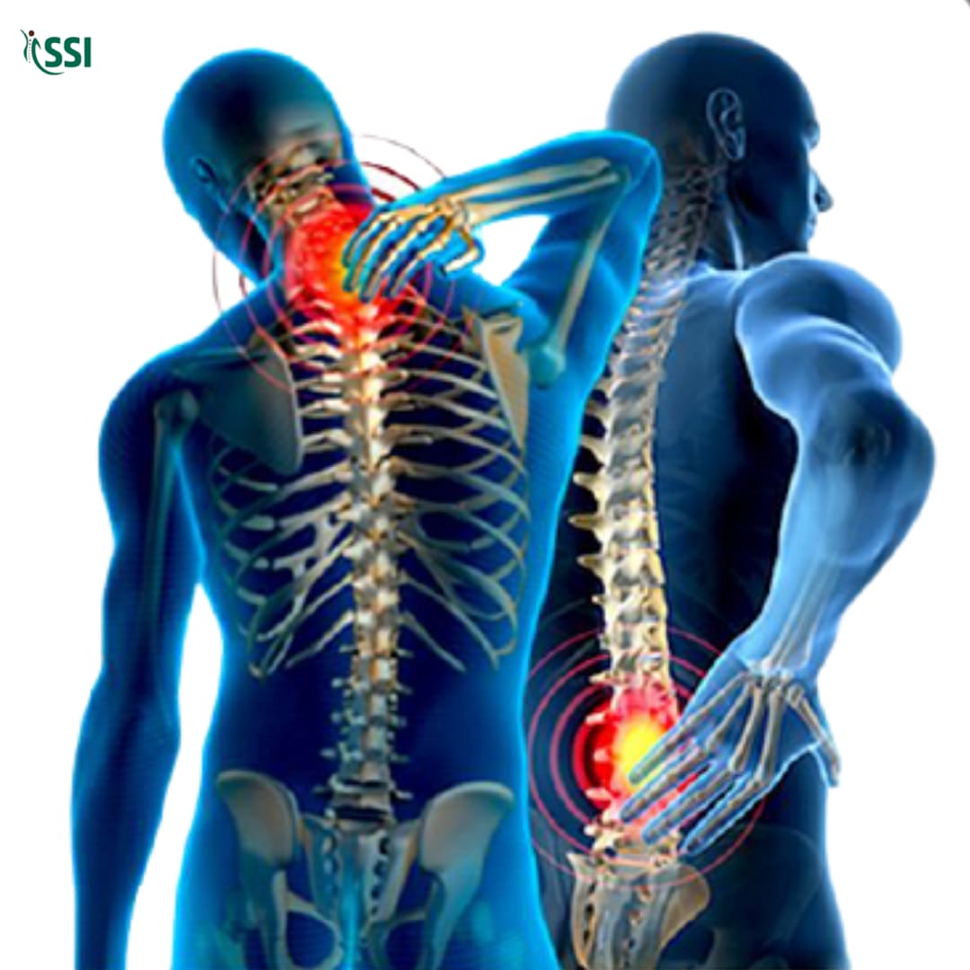 spinal tuberculosis research articles