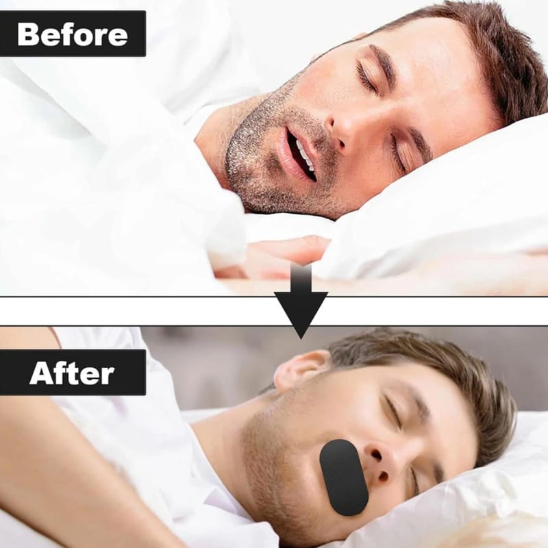 Hypoallergenic Closed Mouth Sleep Tape with Breathing Slot (30 Pcs) thumbnail 3