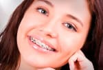 Ortodoncia con brackets metálicos por $4.990