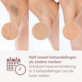 Philips Lumea IPL 9900 Series BRI951/01 voor €375 bij Bol