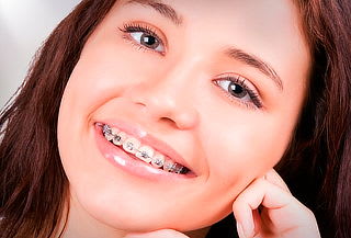 Ortodoncia con brackets metálicos por $4.990