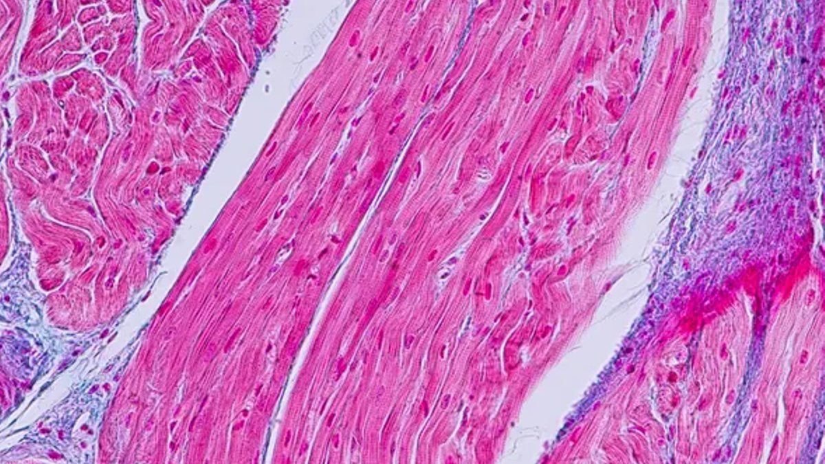 Medtronic backs CoreMap with $37M funding Medtronic backs CoreMap with $37M funding - cardiac mapping