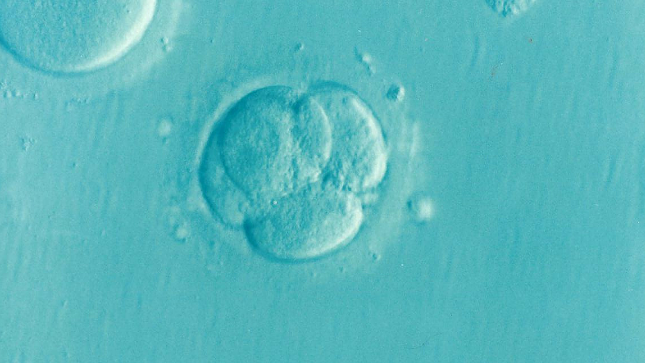 What is IVF