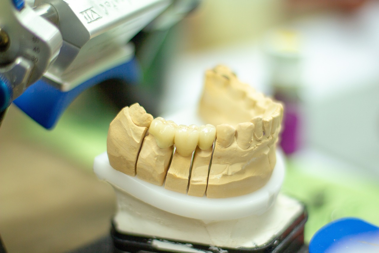 Restorative Dentistry: Bringing Back Your Natural Smile