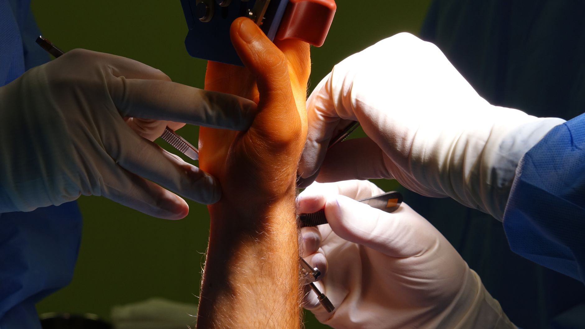 How to Choose the Right Orthopedic Surgeon for Your Needs