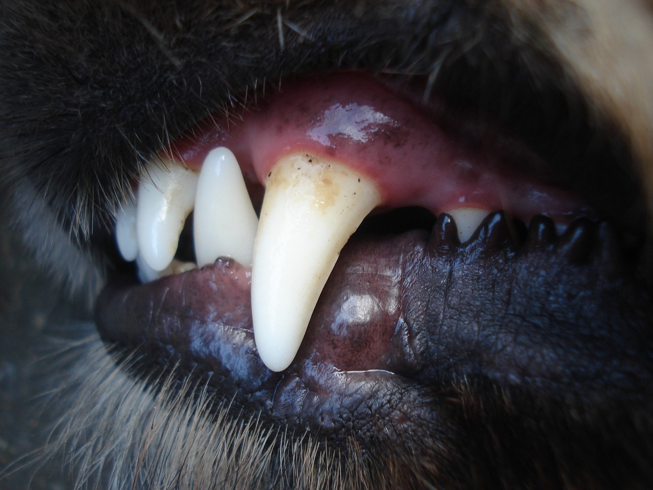 Acrylic partial dentures and how it fits
