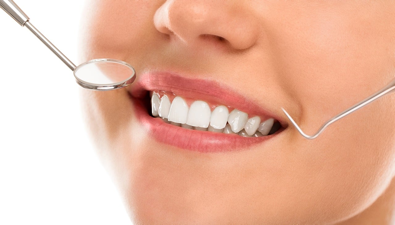 Common Myths About Teeth Whitening Debunked