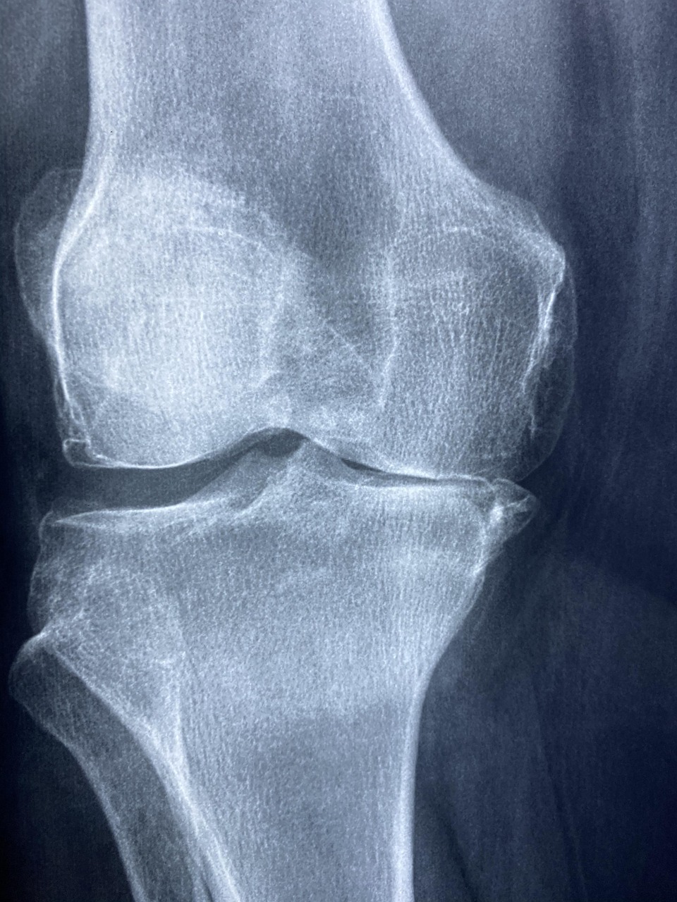 X-Ray Radiology Is Beneficial for Critical Diseases