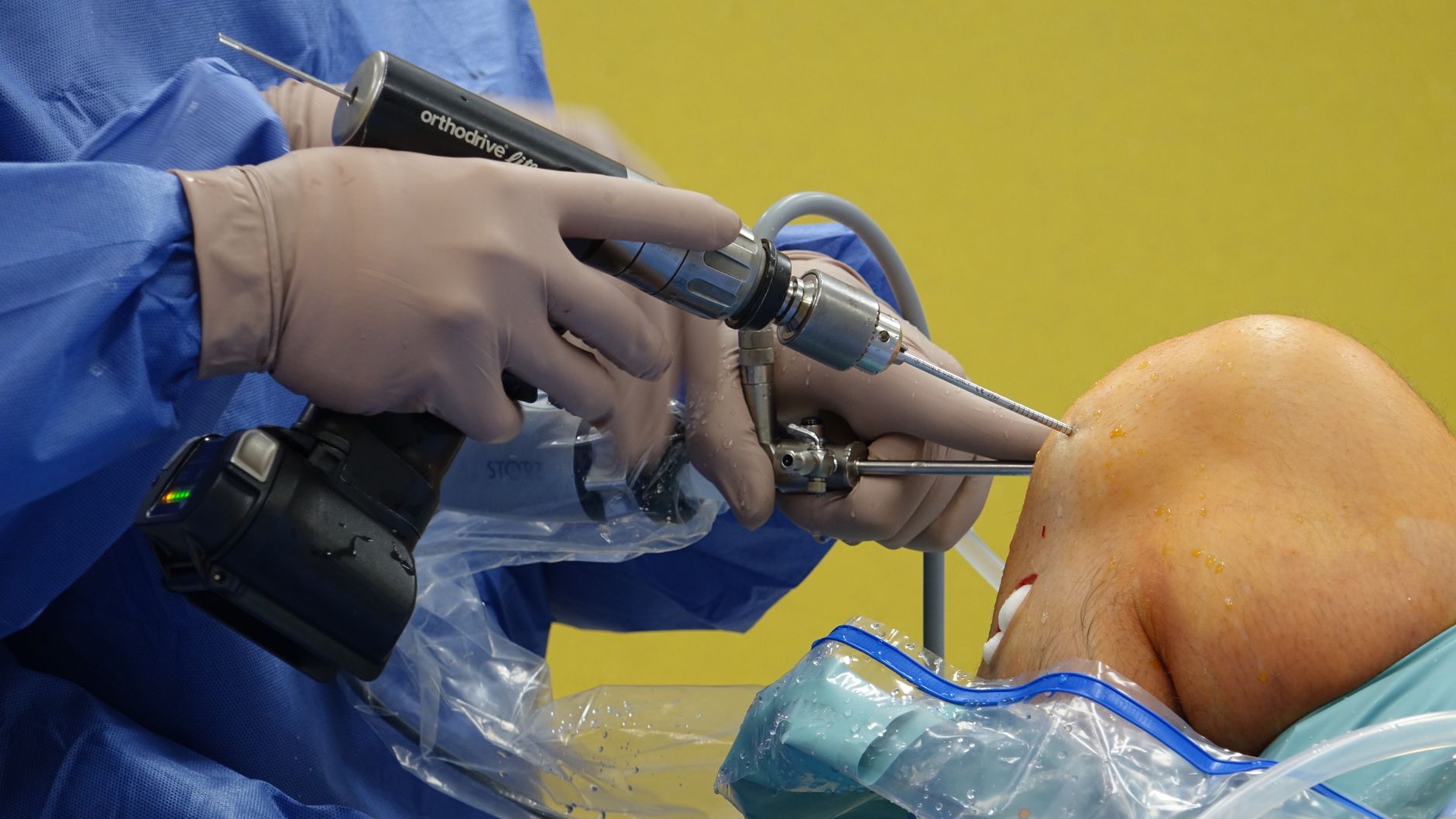 Orthopedic Surgeons and Sports Injuries: What You Need to Know